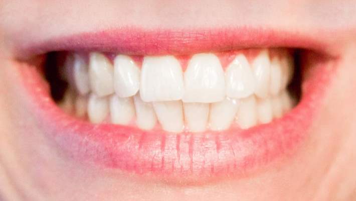 Neden Dişlerimizi Gıcırdatırız?