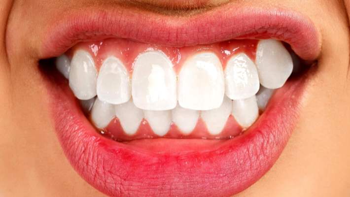 Dişleri Gıcırdatmanın Sağlığa Zararları