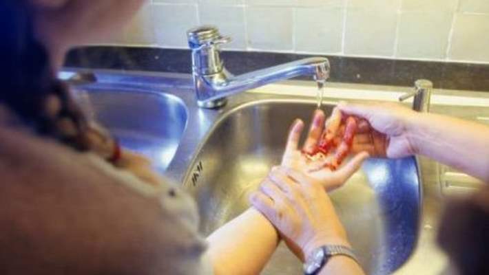 Yara Bakımı Tedavisi