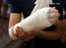 Colles Kırığı Colles Kırığı