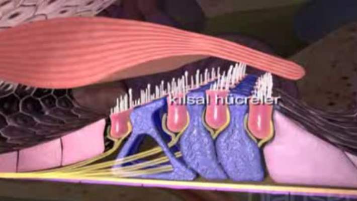 Kıl Yolma Hastalığı