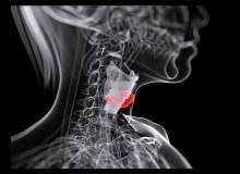 Folik Asit Gırtlak Kanserini Önlemeye Yardım Edebilir Folik Asit Gırtlak Kanserini Önlemeye Yardım Edebilir