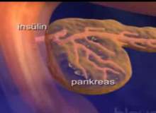 Pankreas Kanserini Değerlendirme