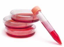 Kanser Kan Testleri: Kanser Teşhisinde Kullanılan Laboratuar Testleri