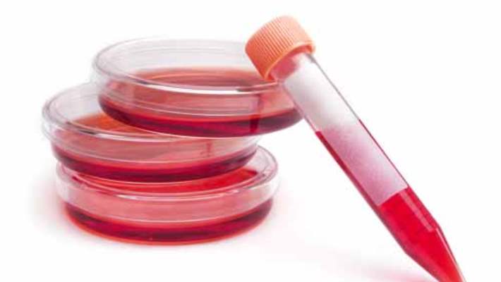 Kanser Kan Testleri: Kanser Teşhisinde Kullanılan Laboratuar Testleri