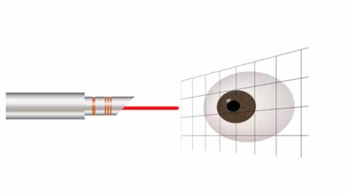 Lasik Göz Ameliyatı