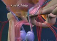Kasık Çekilmesi mi Fıtık mı Kasık Çekilmesi mi Fıtık mı