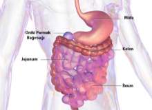 Crohn Hastalığı Hakkında 5 Yanlış İnanış