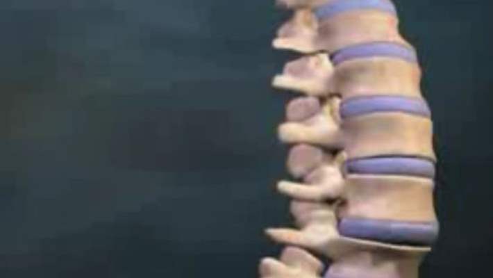 Omurga Kırıkları İçin Fiziksel Terapi
