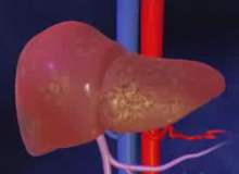 Karaciğer Enzimlerinde Yükselme Karaciğer Enzimlerinde Yükselme