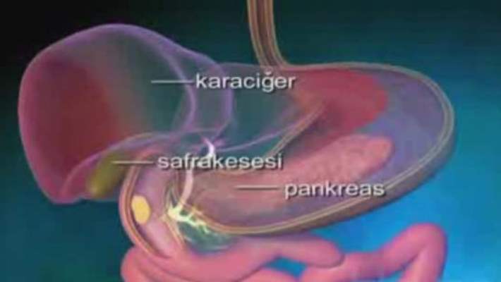 Sindirim Hastalıklarında Görüntüleme Testleri