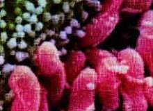 Üre Nefes Testi ve Helikobakter Pilori Üre Nefes Testi ve Helikobakter Pilori