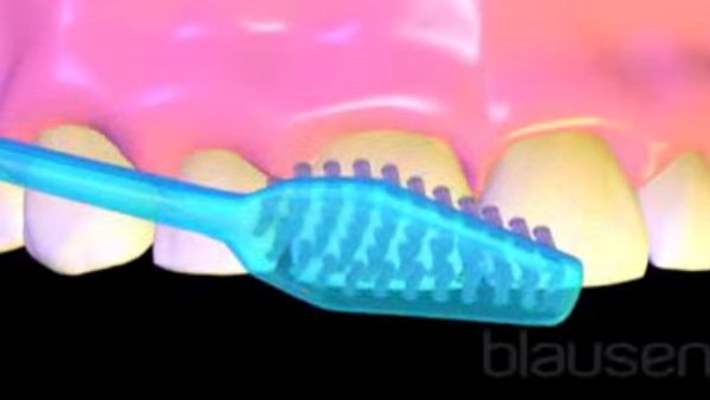 Diş Sağlığı Ve Diş Renginde Bozulma