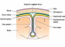 Menenjit - Teşhiste Gecikme ve Ölümcül Olabilecek Sonuçları Menenjit - Teşhiste Gecikme ve Ölümcül Olabilecek Sonuçları