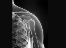 Romatoid Artrit Hakkında En Bilinen 8 Söylenti Romatoid Artrit Hakkında En Bilinen 8 Söylenti