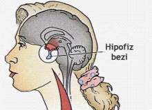 Hipopitüitarizm (Hipofiz Faaliyetinin Azalması)