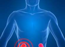 Böbrek Enfeksiyonunu Tedavi Edin Böbrek Enfeksiyonunu Tedavi Edin