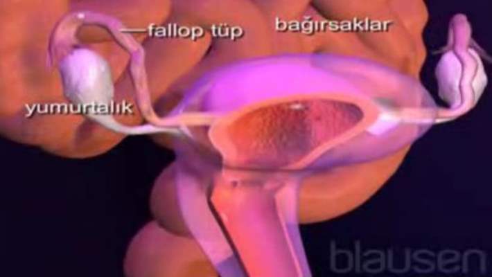 Endometriyoz İçin Diğer Tedaviler