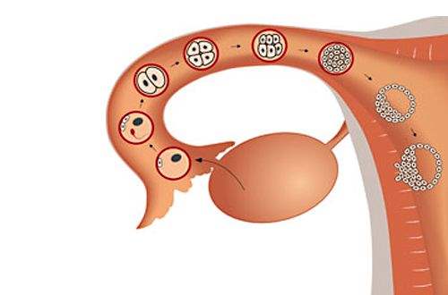 Endometriyozda Ağrıyı Azaltma