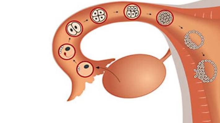 Endometriyozda Ağrıyı Azaltma