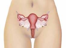 Endometriyoz Tedavisine Genel Bakış Endometriyoz Tedavisine Genel Bakış