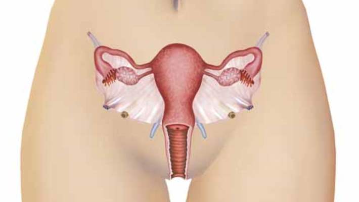 Endometriyoz Tedavisine Genel Bakış