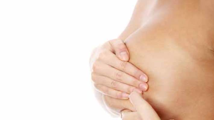 Meme Kistleri Nasıl Tedavi Edilir Ve Önlenir