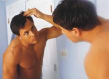 Saçkıran Hastalığından Kimler Etkilenebilir Saçkıran Hastalığından Kimler Etkilenebilir