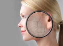 Akne, Dünyaya Bakışınızı Değiştirebilir Akne, Dünyaya Bakışınızı Değiştirebilir