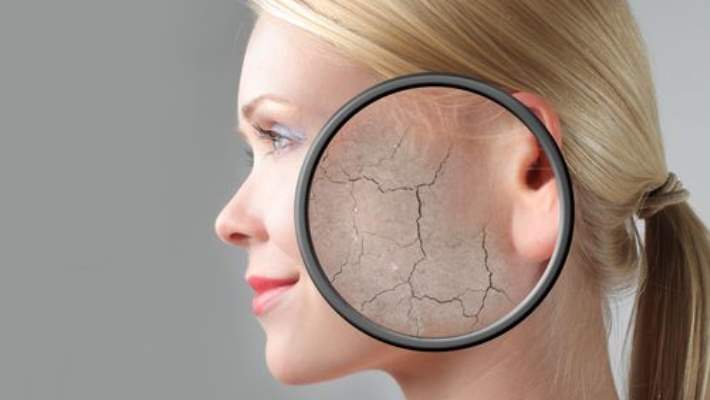 Akne, Dünyaya Bakışınızı Değiştirebilir