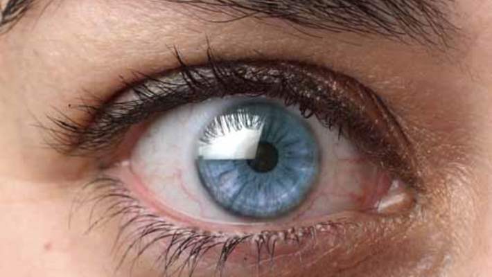 gozde ucusan lekeler hemen saglik