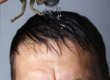 Sıcak Yorgunluğu Evde Nasıl Tedavi Edilir Sıcak Yorgunluğu Evde Nasıl Tedavi Edilir