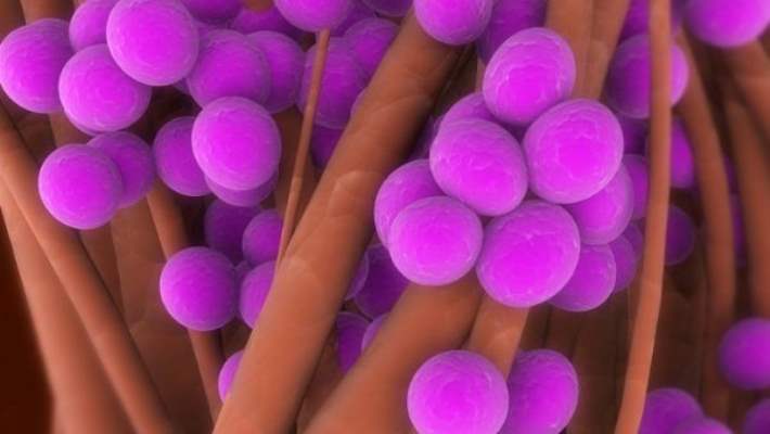 Ağır Staph Enfeksiyonlarında Bağ Bulundu