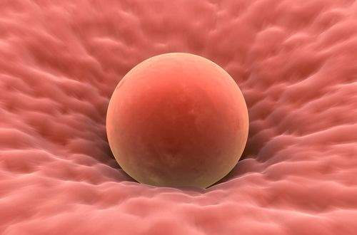 Endometriyozun Sebepleri