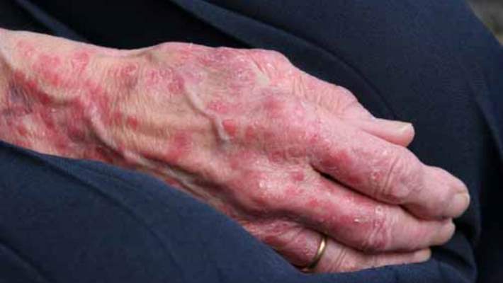 Cilt Yaşlanması Efsaneleri Ve Ardında Yatan Gerçekler