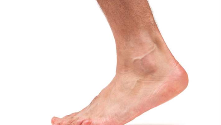 Çatlamış Topuklar Ve Nasırlar İçin Çözüm: Ayak Bakımı