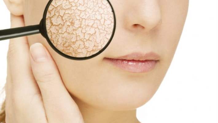 kuru cilt bakimi kuru cildi koruma evde uygulanan tedaviler ve daha fazlasi hemen saglik