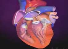 Kalp Hastalıkları ve Homosistein