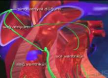 Kalp Hastalıkları ve Restriktif Kardiyomiyopati