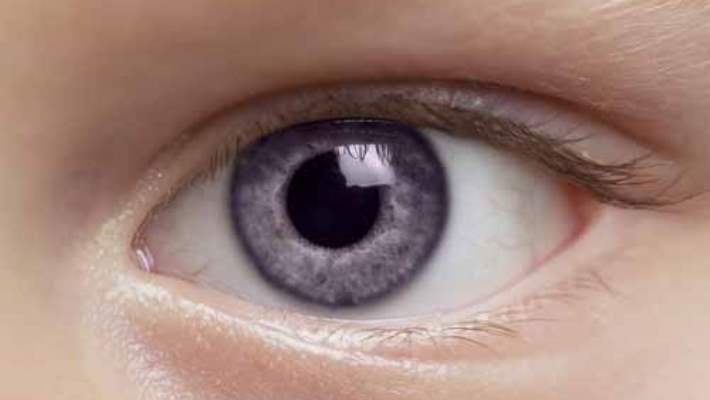 Renk Körlüğü Tedavisi Olmayan Bir Durumdur