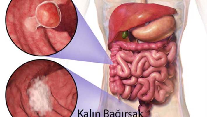 Kozmetik Diş Hekimliğinin Başarısı Gülüşünüzün Başarısında