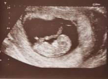 Kürtaj Mı Yaptıracaksınız? Kürtaj Mı Yaptıracaksınız?