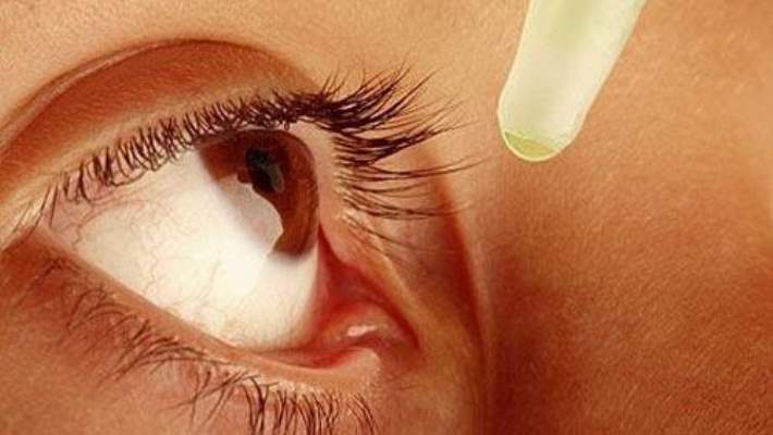 kirpikler ve kirpik batmasi hemen saglik