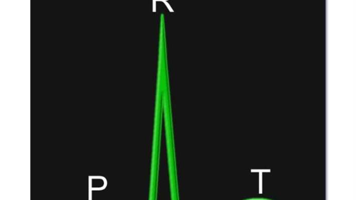 Stent Sonrası Kan Sulandırıcı İlaçlarla Tedavi Süresi Tartışmaya Açılıyor