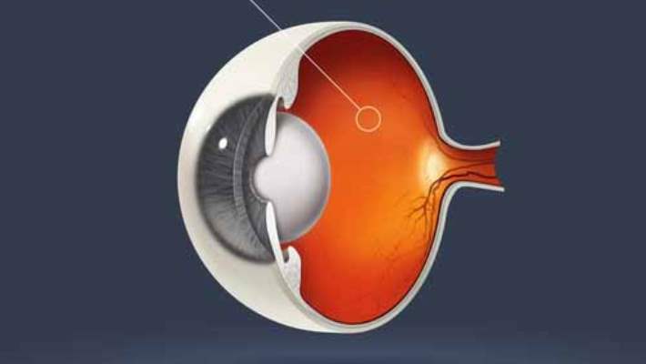 Retina Dekolmanları