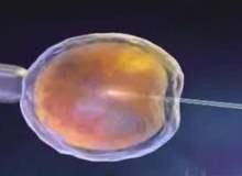 Tüp Bebek Tedavisinde Gömülme Sorununa Aşı Tüp Bebek Tedavisinde Gömülme Sorununa Aşı