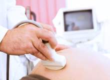 Hamileliğin 10. haftasında bebekteki en önemli gelişme nedir? Hamileliğin 10. haftasında bebekteki en önemli gelişme nedir?