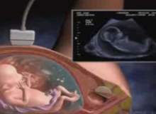 Hamileliğin 11. haftasında bebeğin duyuları ne durumdadır? Hamileliğin 11. haftasında bebeğin duyuları ne durumdadır?