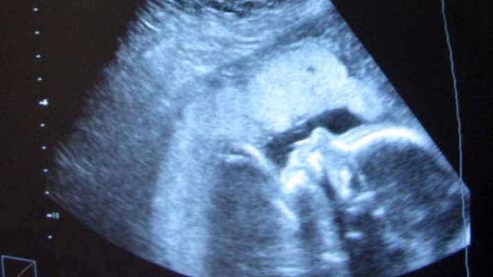 Hamileliğin 1. Haftası Hangi Dönemdir?