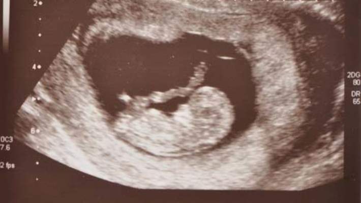 Hamileliğin 2. Haftasında Aslında Neler Yaşanır?